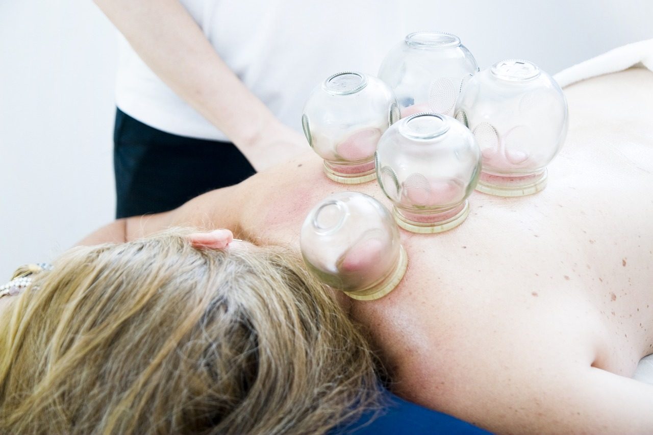 cupping-therapy-6604217_1280